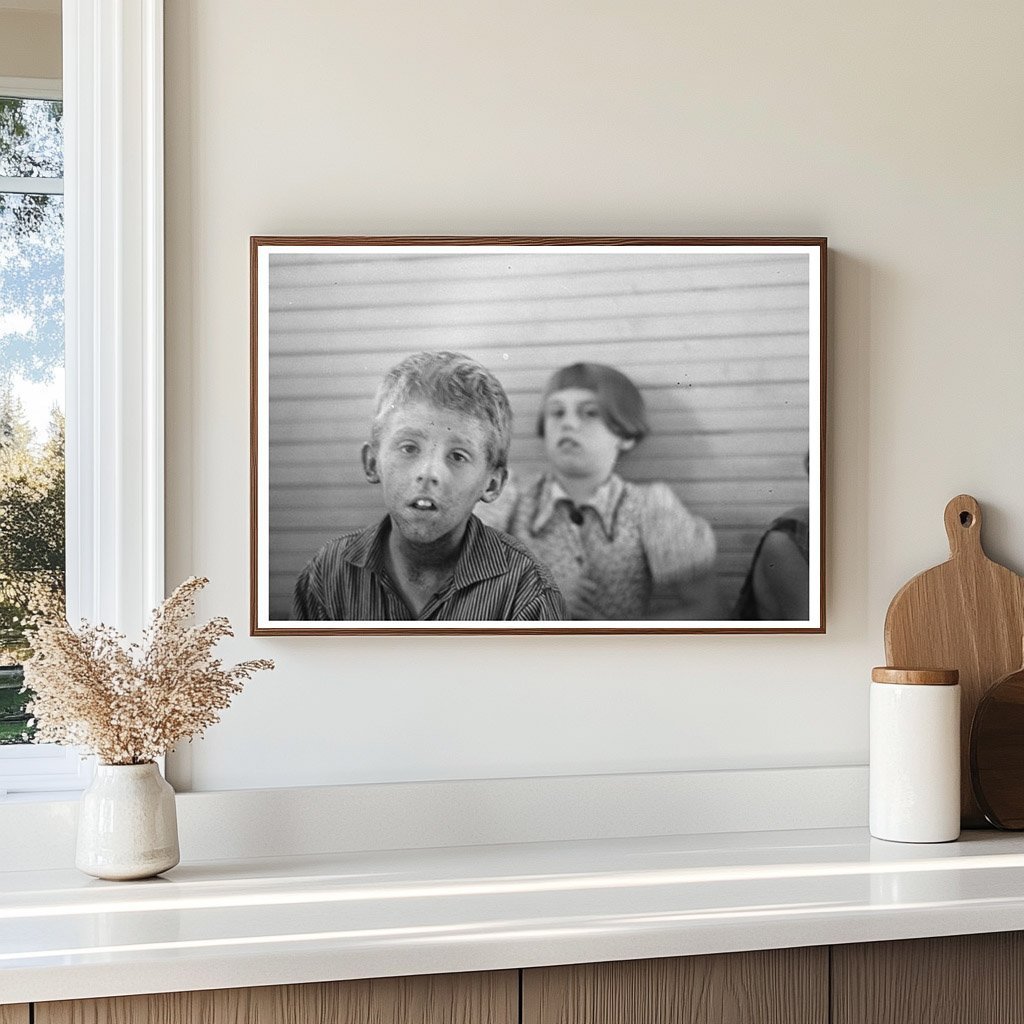 1937 Vintage Photo of North Dakota Boy with Eczema - Available at KNOWOL