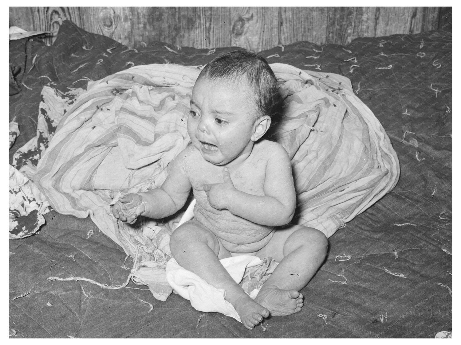 Mexican Baby with Impetigo Crystal City Texas 1939