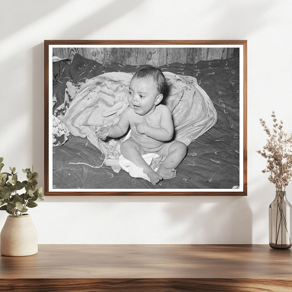 Mexican Baby with Impetigo Crystal City Texas 1939