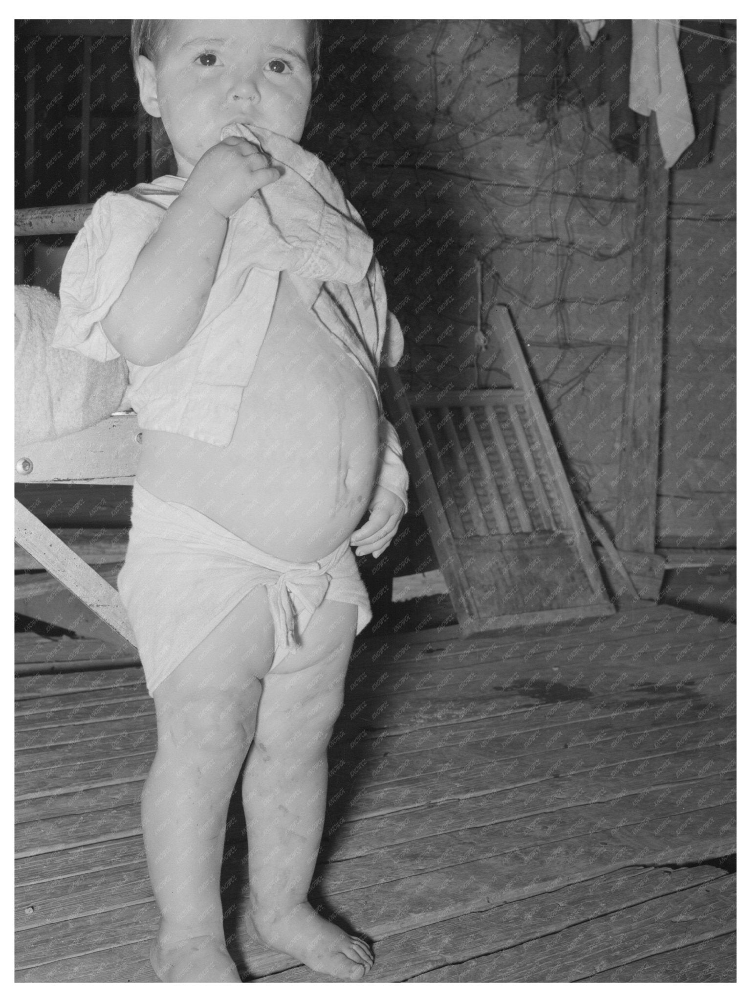 Child with malnutrition near Warner Oklahoma June 1939 - Available at KNOWOL