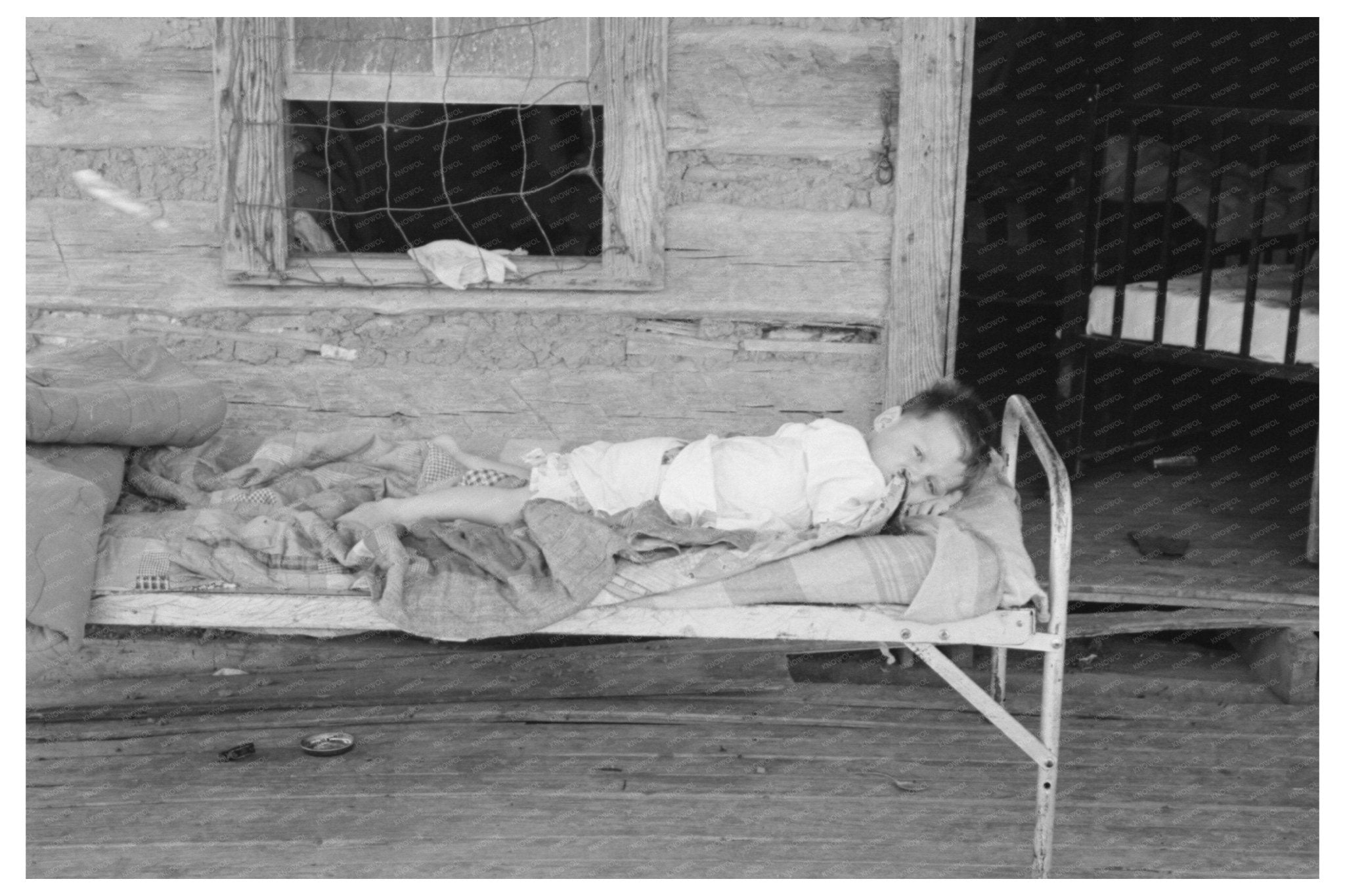 Child with Spinal Tuberculosis on Farm Porch June 1939 - Available at KNOWOL