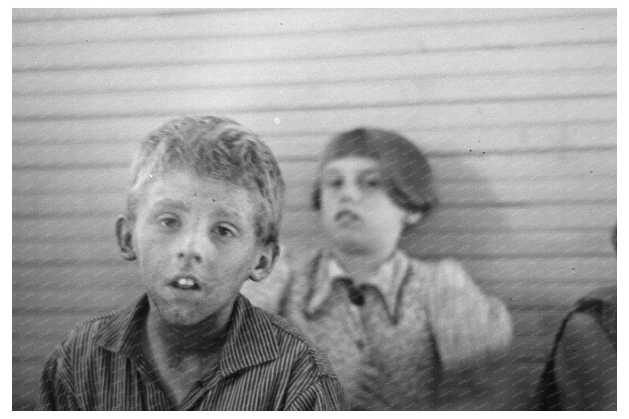 1937 Vintage Photo of North Dakota Boy with Eczema - Available at KNOWOL