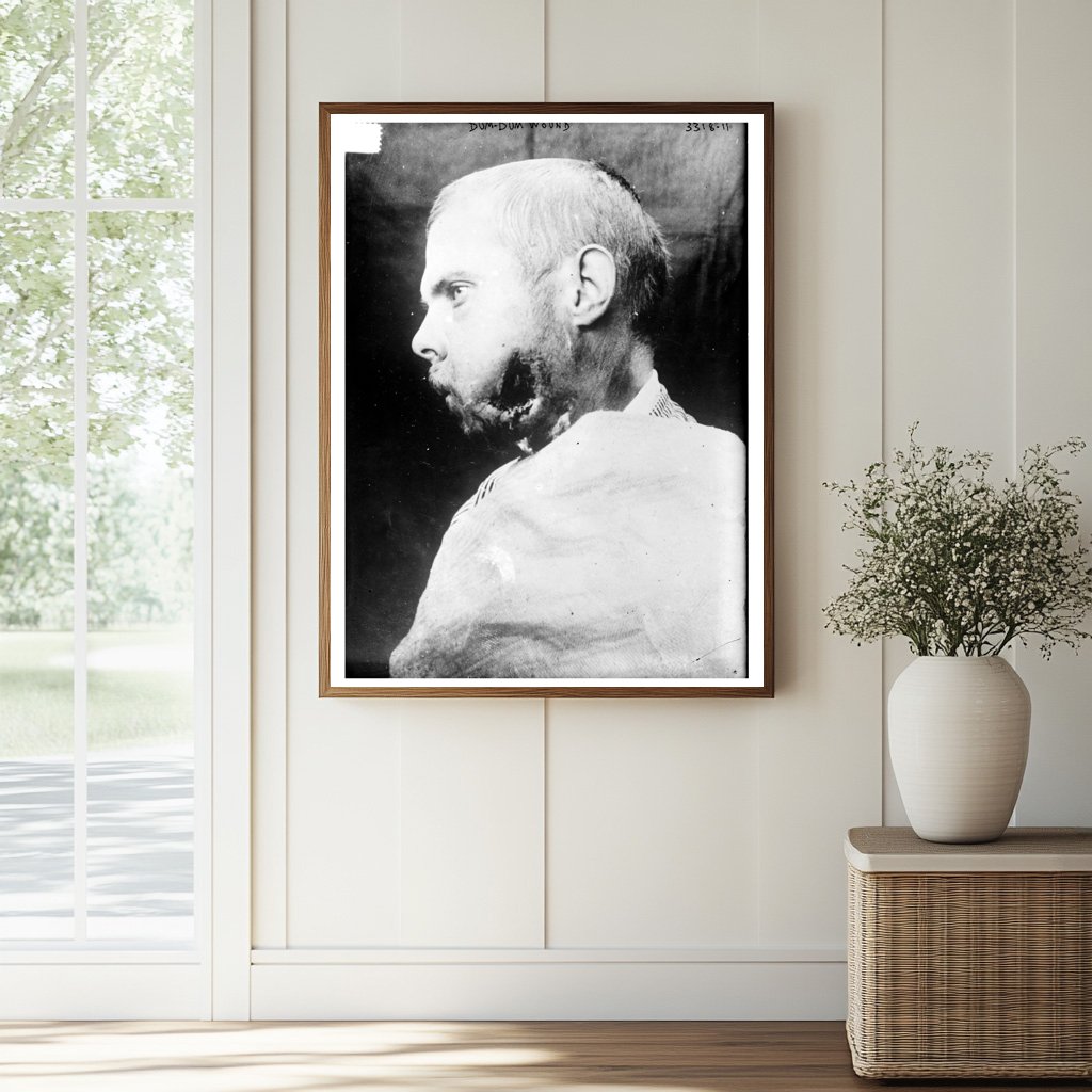 Historic Dum-Dum Wound [man] Print, Vintage Art