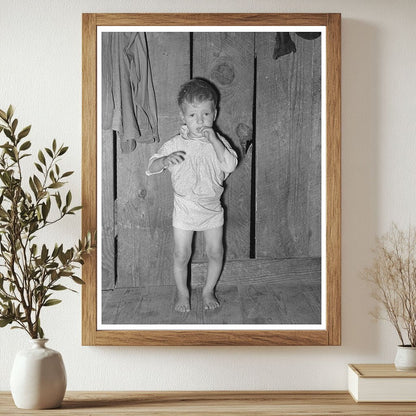 Child with Rickets in Jefferson Texas March 1939