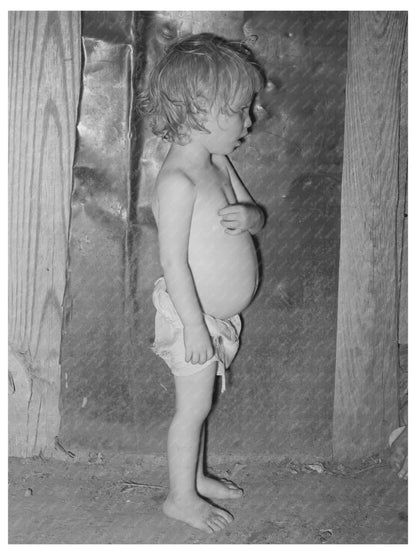 Malnourished Child of Agricultural Laborer Tullahassee 1939