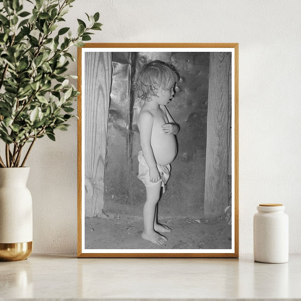 Malnourished Child of Agricultural Laborer Tullahassee 1939