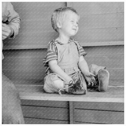 Baby with Club Feet in FSA Camp California May 1939 - Available at KNOWOL