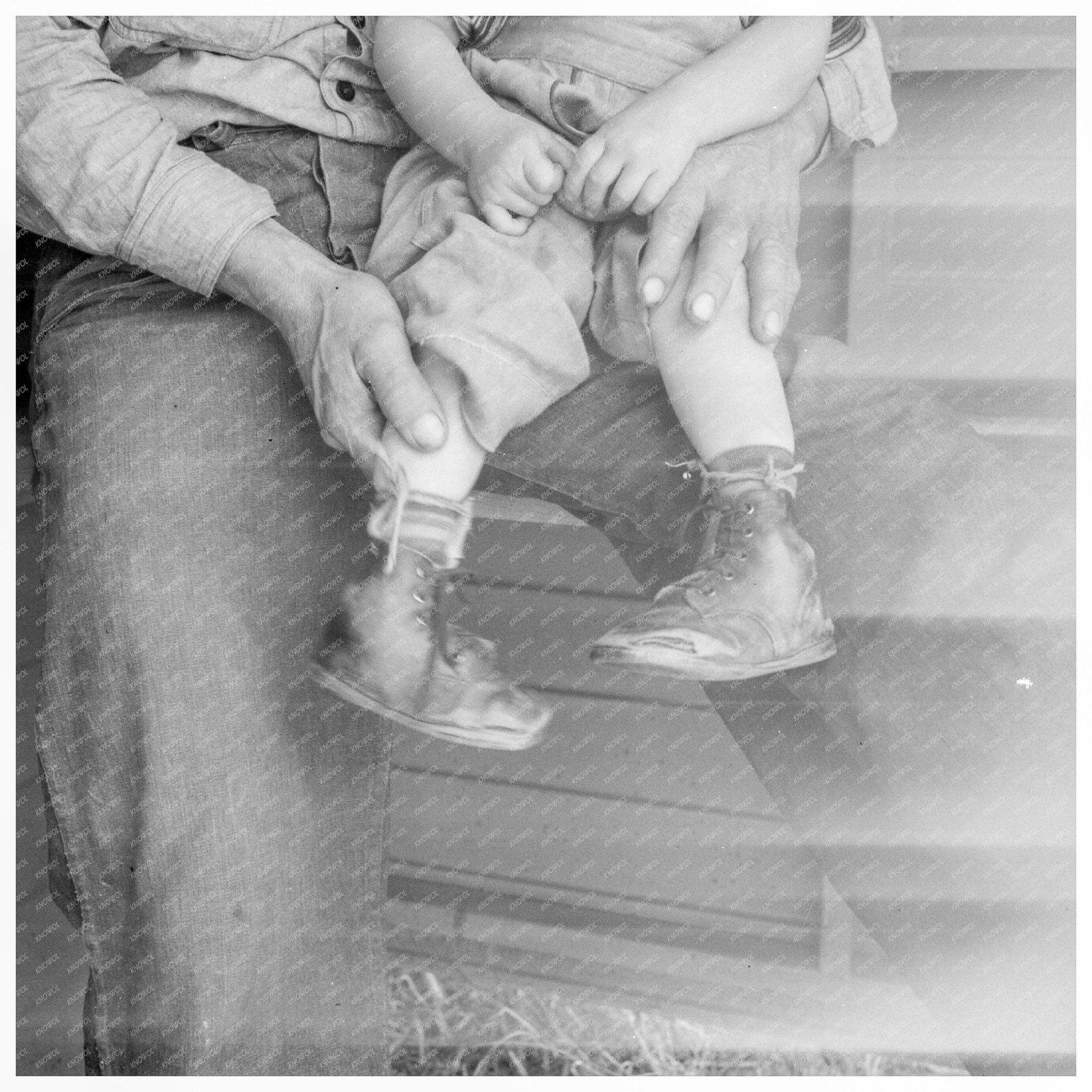 Baby with Club Feet in Splints May 1939 FSA Camp California - Available at KNOWOL