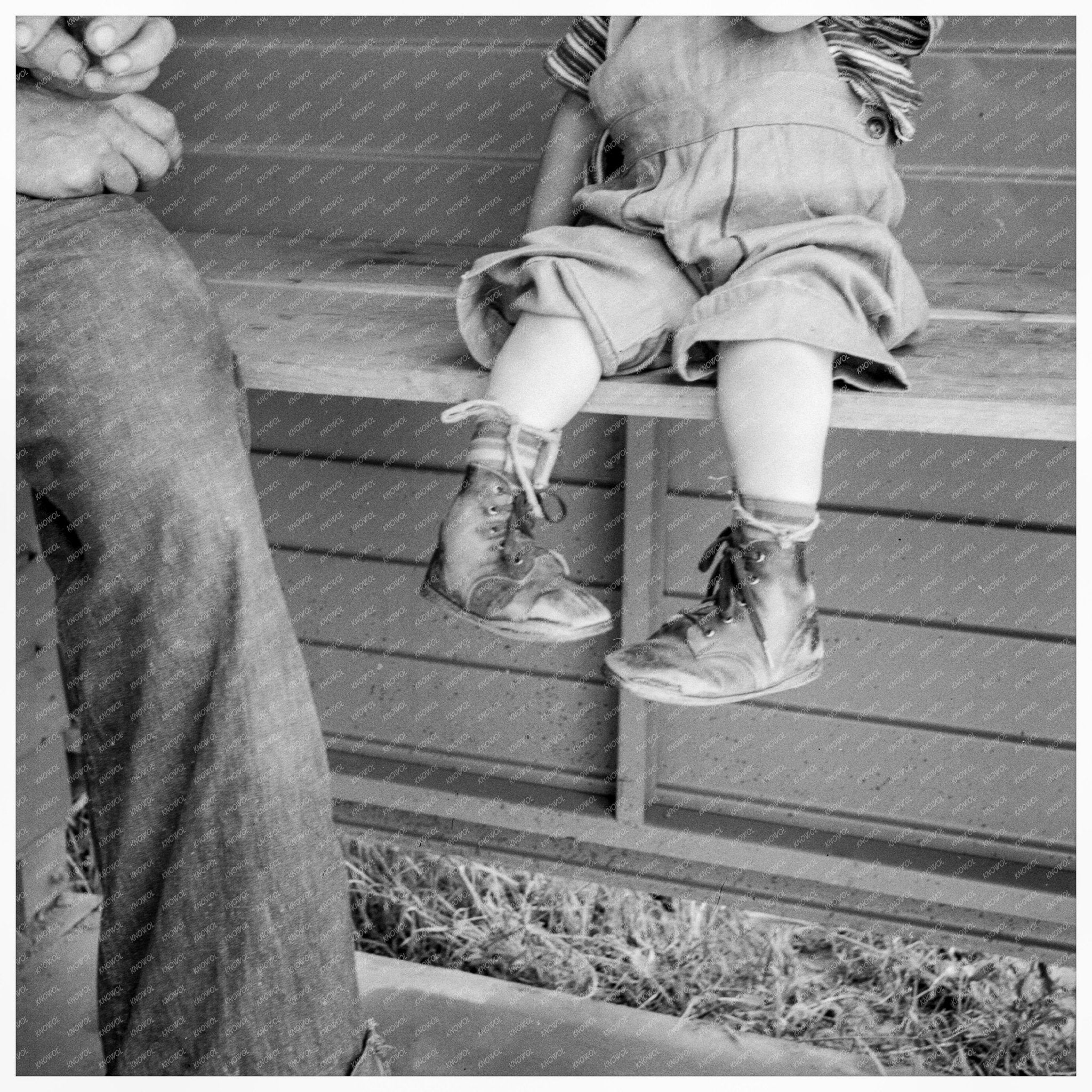 Baby with Club Feet in Splints Tulare County 1939 - Available at KNOWOL