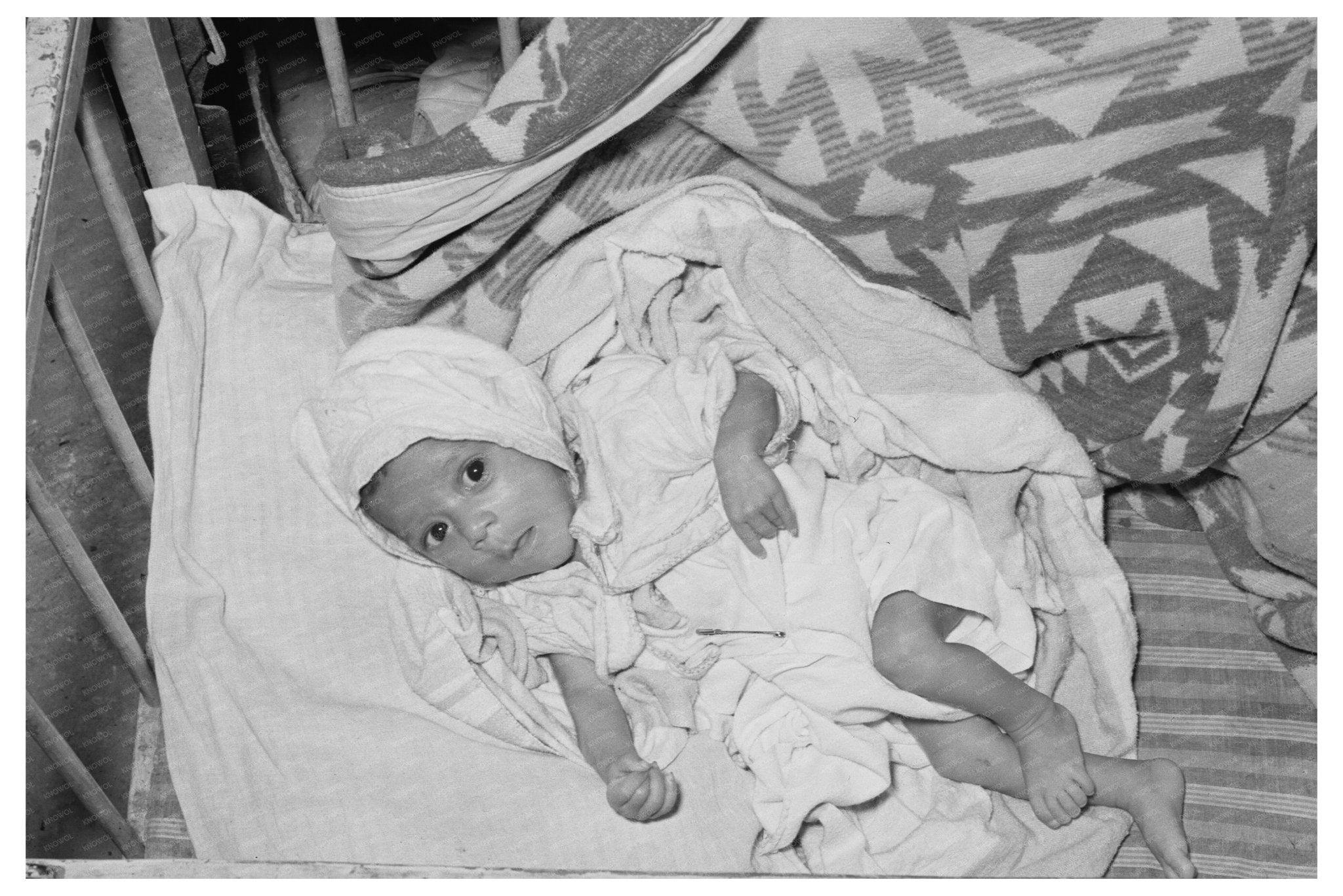 Malnourished Mexican Infant in Crystal City Texas 1939 - Available at KNOWOL